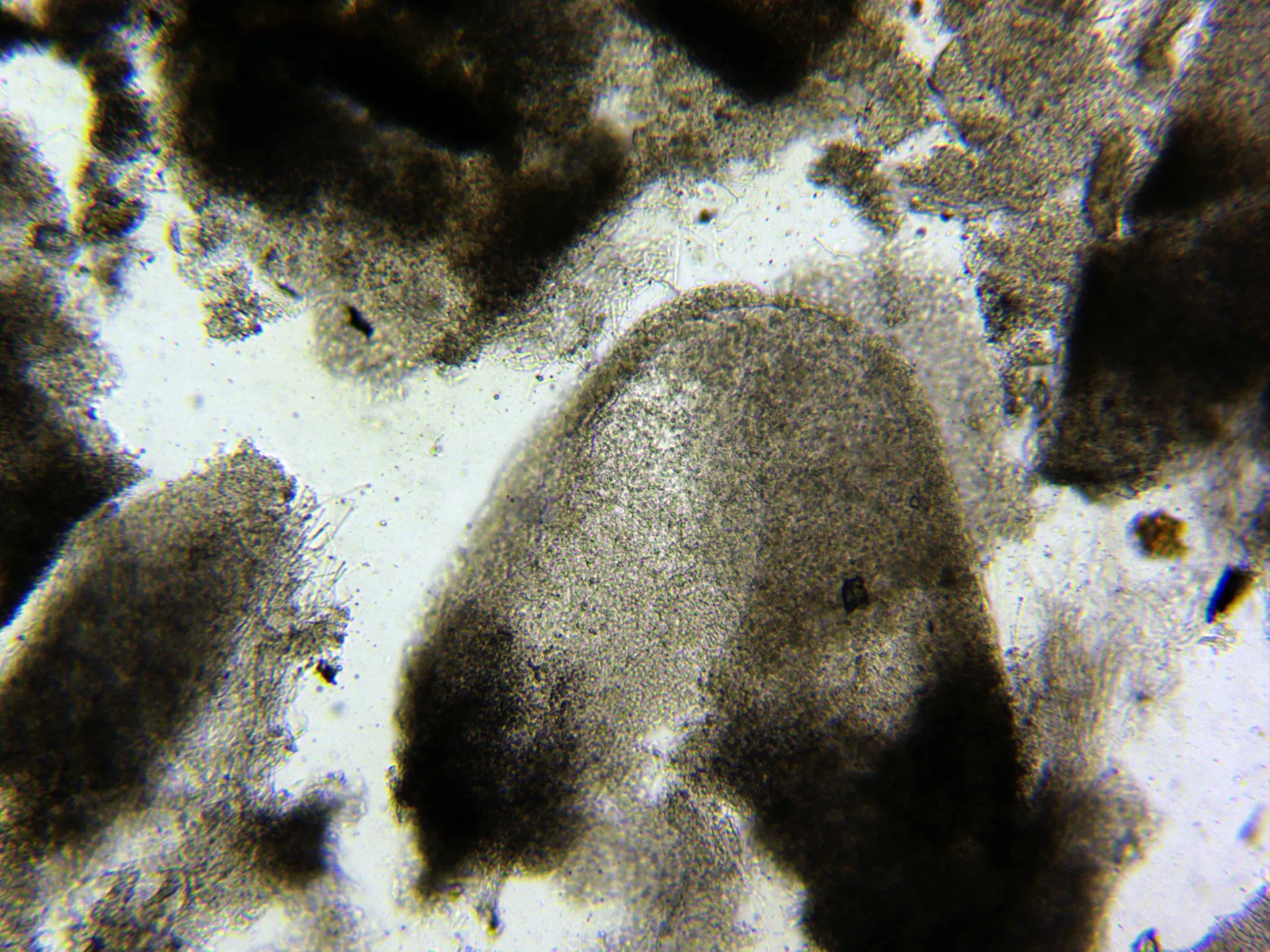 Microscopía de Skeletocutis amorpha - 10 - Sección x 100